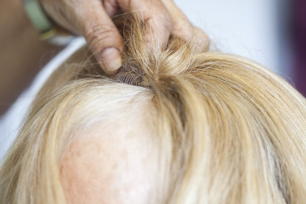 Blog - kale plakken zelfvertrouwen - Haarinstituut Nederland